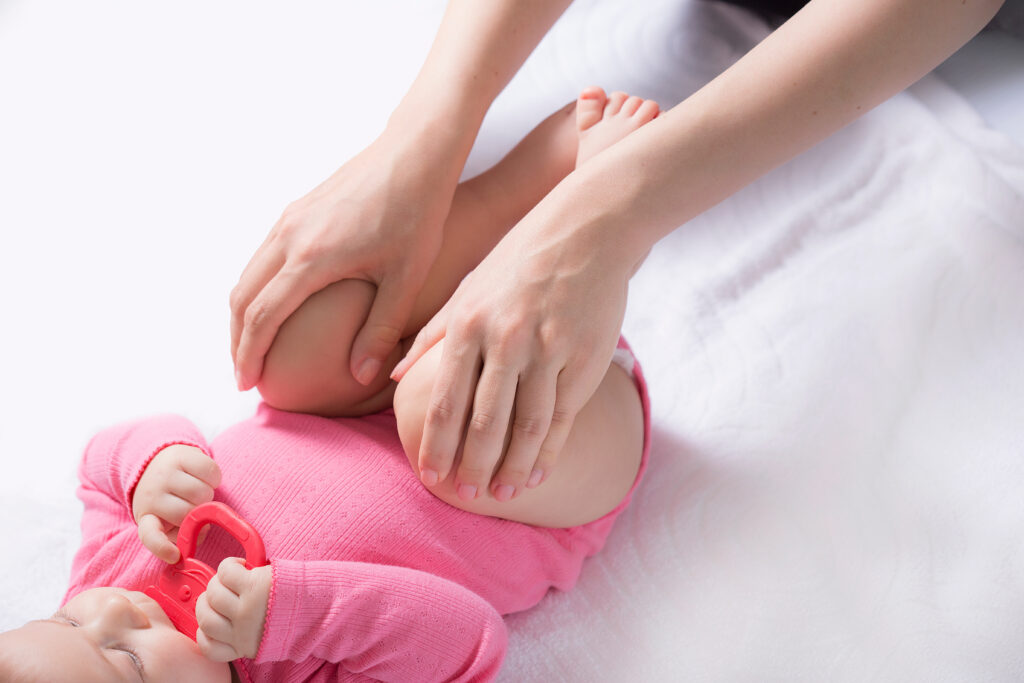 Hip Dysplasia in Infants: Risks & Treatment