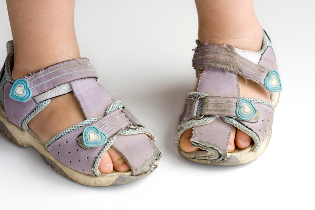 In-Toeing & Out-Toeing: What Parents Need to Know About Toddler Gait